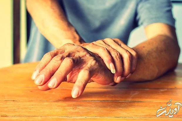 ورزش بیماری پارکینسون